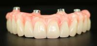 Dentures Plus image 8